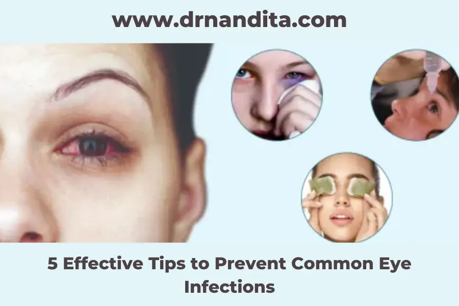 Tips to Avoid Eye Infections | Ophthalmologist in Chembur